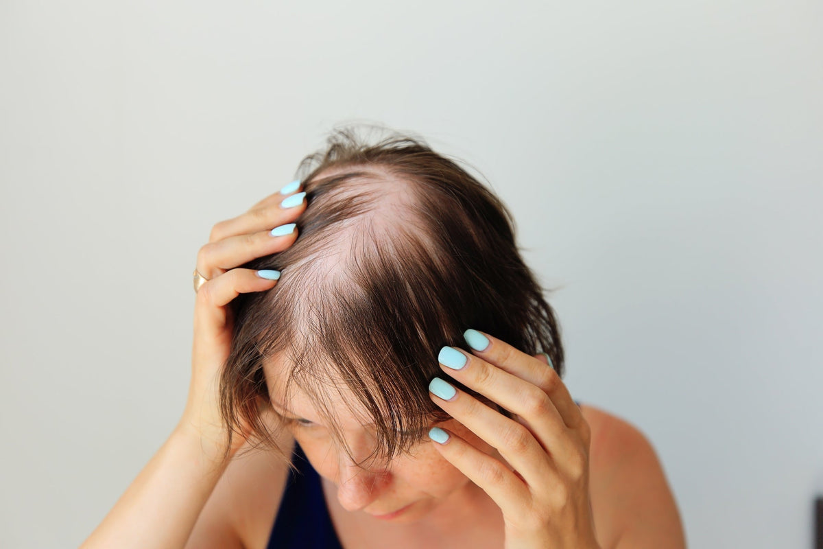 Understanding Hair Loss: 6 Common Causes of Hair Loss - Kim Kimble Hair
